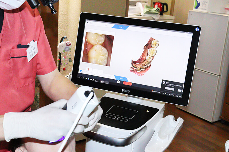 口腔内3Dスキャナー