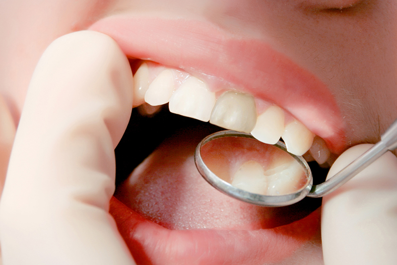 「歯を残す」ための精密な根管治療