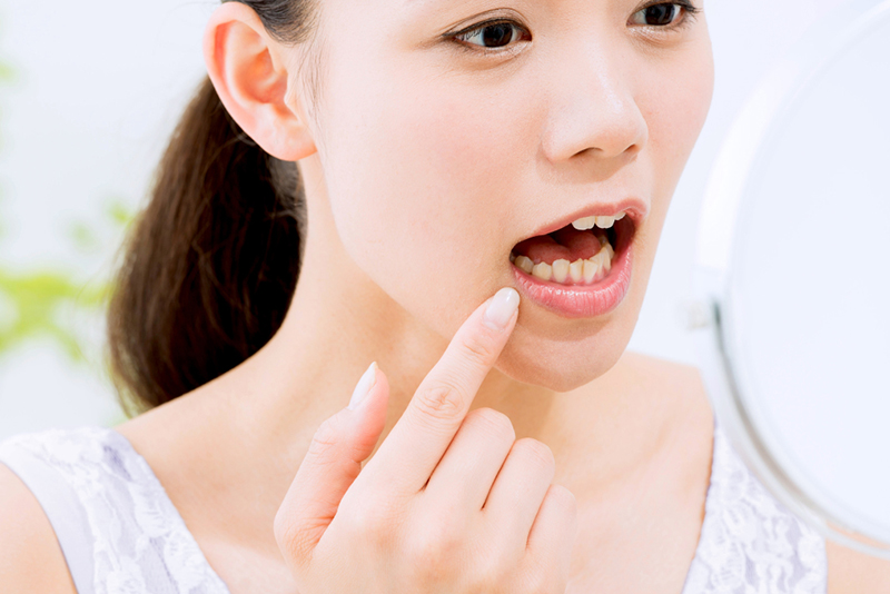 歯に負担がかかることは控えましょう