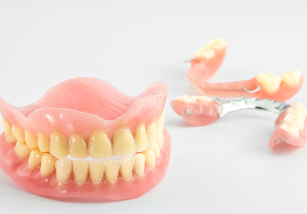 入れ歯（義歯）