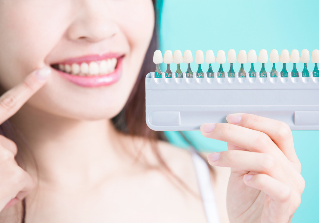 理想の白さへ。あなたに合ったホワイトニングを