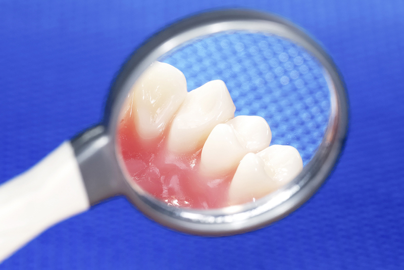 定期的に検診とメンテナンスを受けましょう