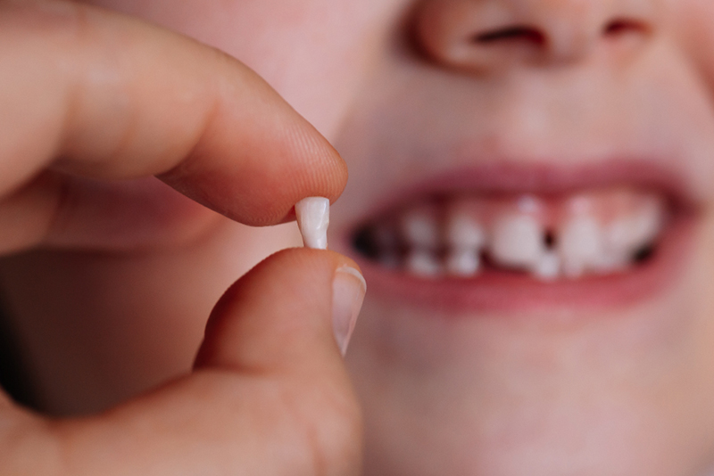 小児歯科の役割