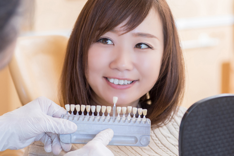 白く輝く歯で笑顔に自信を