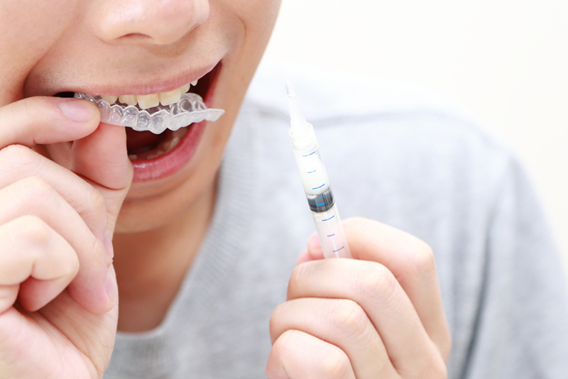 ホームホワイトニングの場合